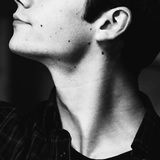 dylansbirthmark